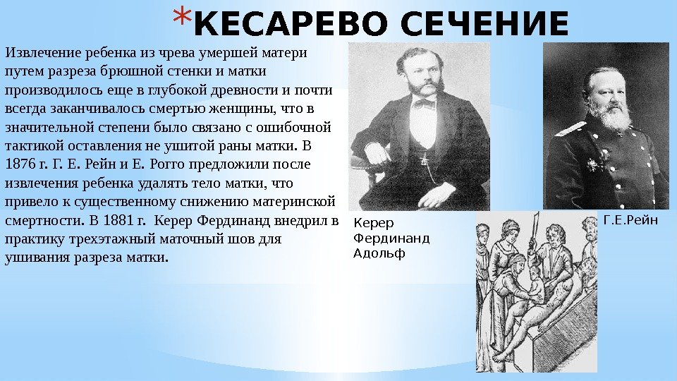 * КЕСАРЕВО СЕЧЕНИЕ Извлечение ребенка из чрева умершей матери путем разреза брюшной стенки и