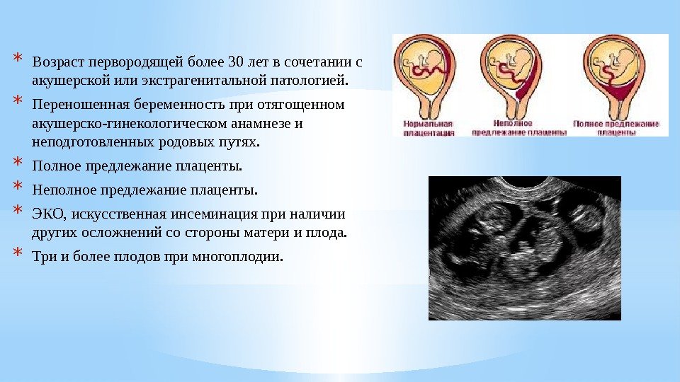 * Возраст первородящей более 30 лет в сочетании с акушерской или экстрагенитальной патологией. *