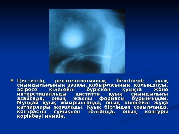 Циститтің рентгенологиялық белгілері; қуық сиымдылығының азаюы, қабырғасының қалыңдауы, әсіресе кілегейлі бүріскен Циститтің рентгенологиялық белгілері; қуық сиымдылығының азаюы, қабырғасының қалыңдауы, әсіресе кілегейлі бүріскен