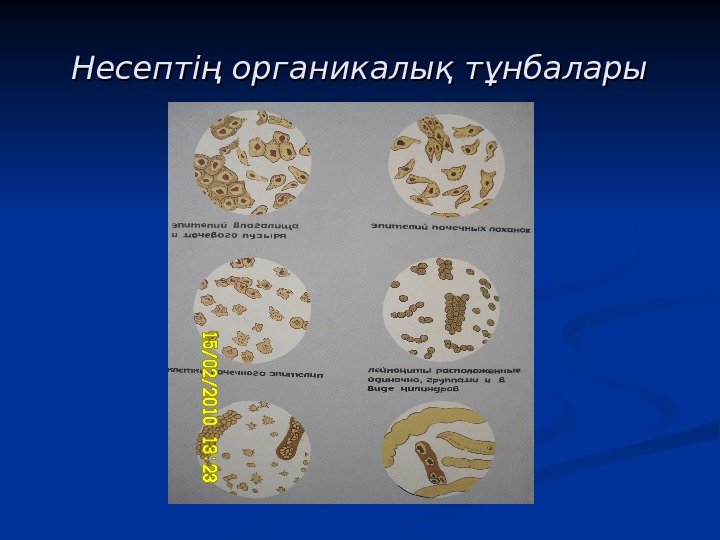 Несептің органикалық тұнбалары Несептің органикалық тұнбалары