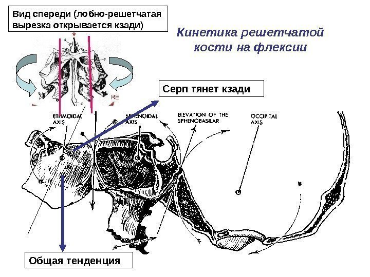 Кинетика решетчатой кости на флексии Серп тянет кзади Общая тенденция. Вид спереди (лобно-решетчатая вырезка