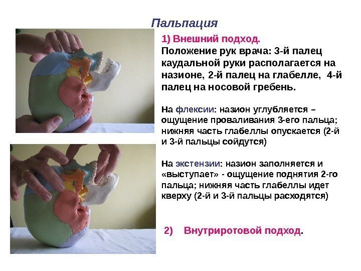 1) Внешний подход. Положение рук врача: 3 -й палец каудальной руки располагается на назионе,