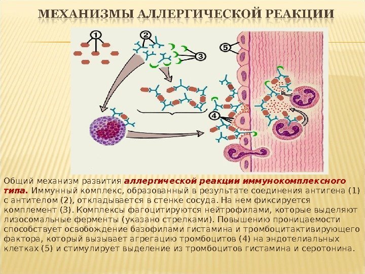 Общий механизм развития аллергической реакции иммунокомплексного типа.  Иммунный комплекс, образованный в результате соединения
