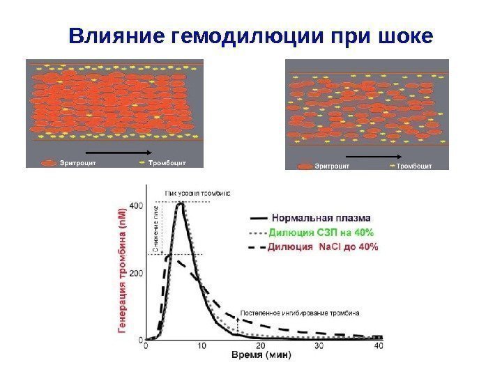 Влияние гемодилюции при шоке 