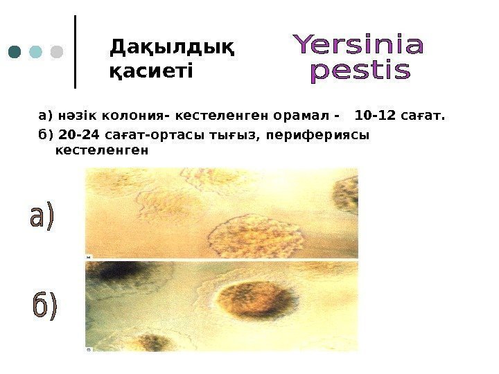 Дақылдық қасиеті  а) нәзік колония- кестеленген орамал - 10 -12 сағат.  б)