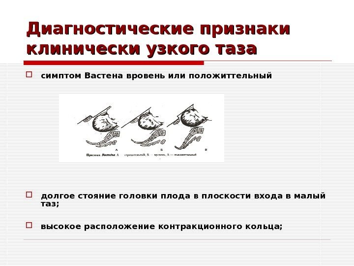 Диагностические признаки клинически узкого таза симптом Вастена вровень или положиттельны й долгое стояние головки