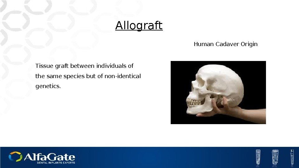 Tissue graft between individuals of the same species but of non-identical genetics. Allograft Human