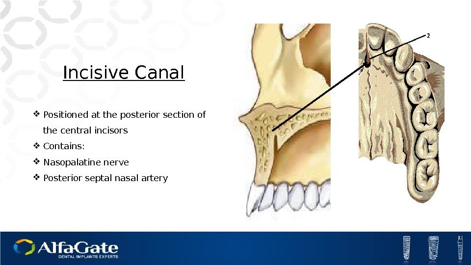 Incisive Canal Positioned at the posterior section of the central incisors Contains:  Nasopalatine