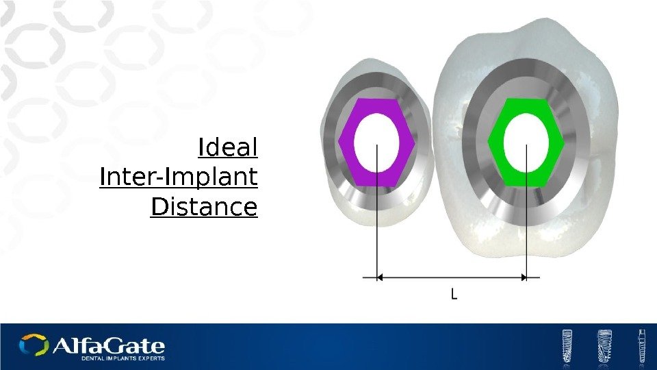 Ideal Inter-Implant Distance 
