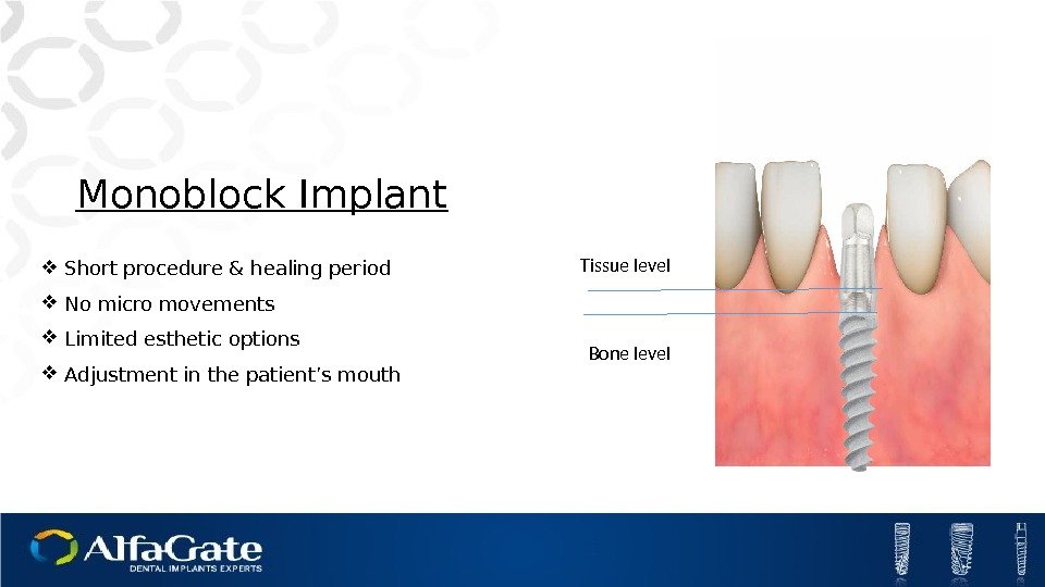 Monoblock Implant Short procedure & healing period No micro movements Limited esthetic options Adjustment