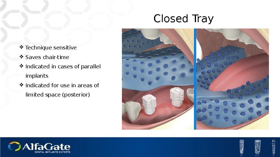 Closed Tray Technique sensitive Saves chair-time Indicated in cases of parallel implants Indicated for