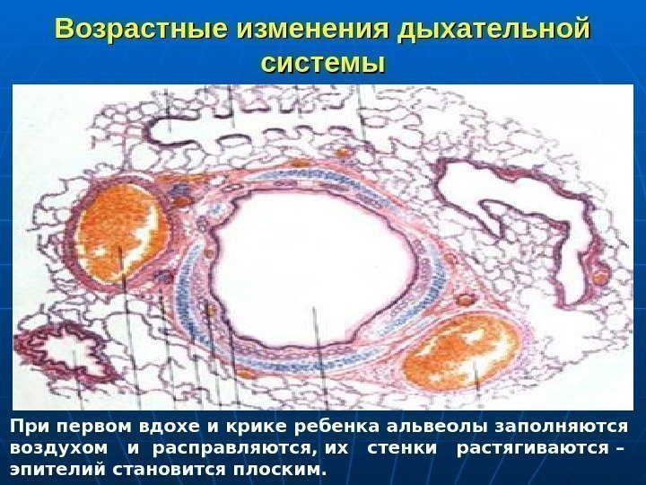   Возрастные изменения дыхательной системы При первом вдохе и крике ребенка альвеолы заполняются