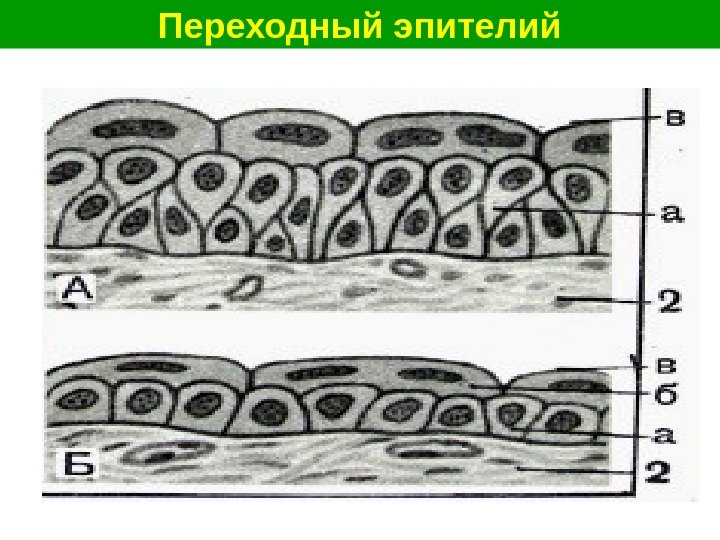   Переходный эпителий 