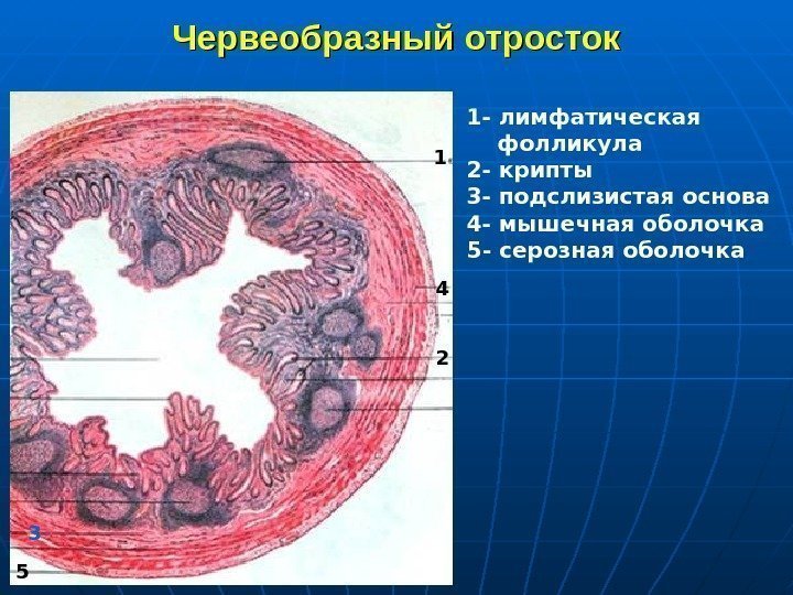   Червеобразный отросток 1 2 1 - лимфатическая фолликула 2 - крипты 3