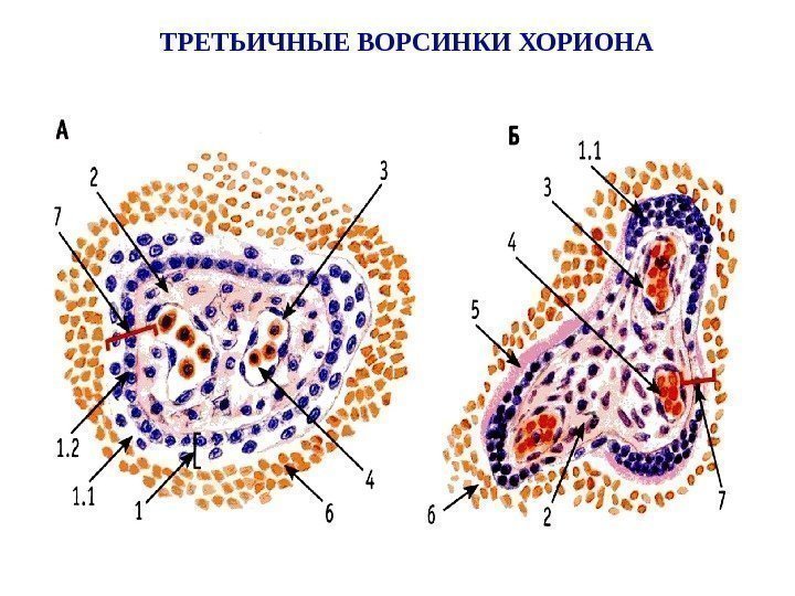   ТРЕТЬИЧНЫЕ ВОРСИНКИ ХОРИОНА 