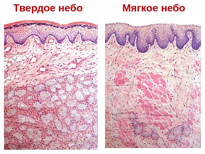  Твердое небо   Мягкое небо 