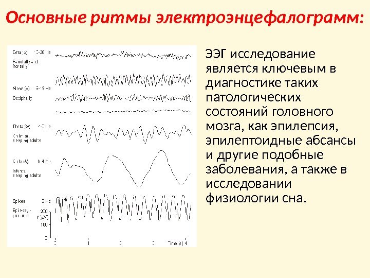 Основные ритмы электроэнцефалограмм:  ЭЭГ исследование является ключевым в диагностике таких патологических состояний головного