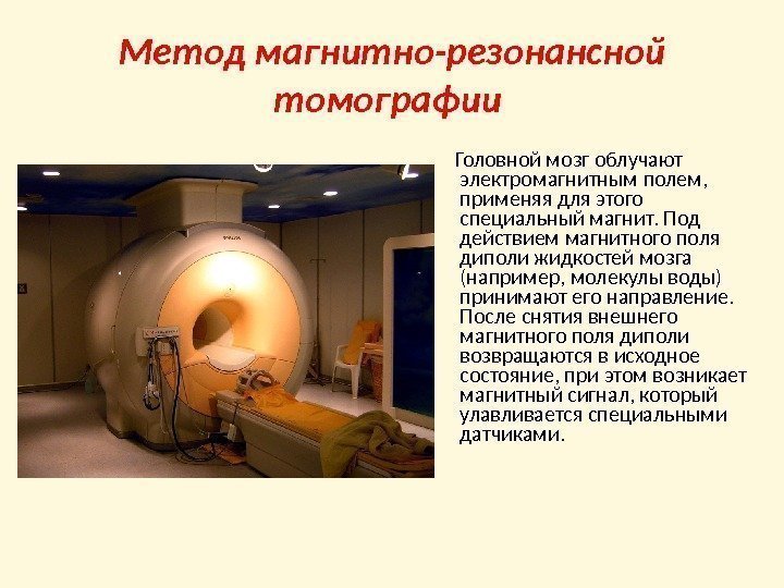 Метод магнитно-резонансной томографии   Головной мозг облучают электромагнитным полем,  применяя для этого