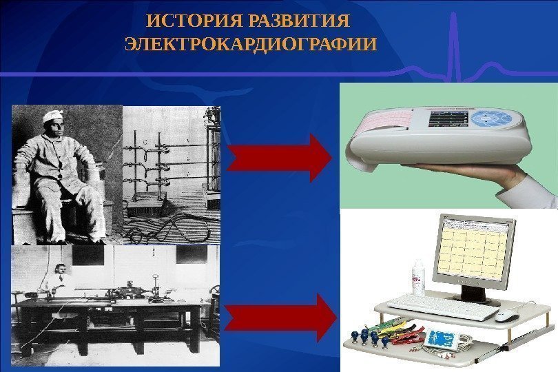 ИСТОРИЯ РАЗВИТИЯ ЭЛЕКТРОКАРДИОГРАФИИ 