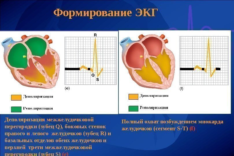 Формирование ЭКГ Деполяризация  межжелудочковой перегородки (зубец Q ), боковых стенок правого и левого