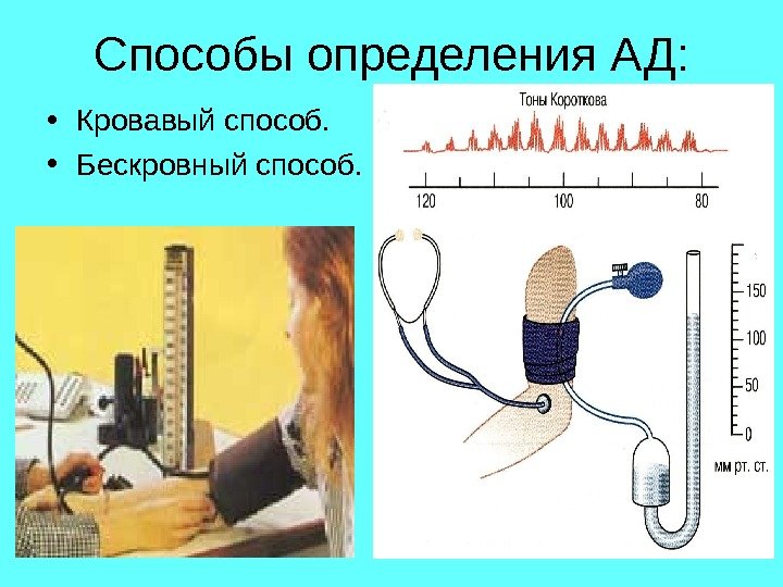 Способы определения АД:  • Кровавый способ.  • Бескровный способ. 