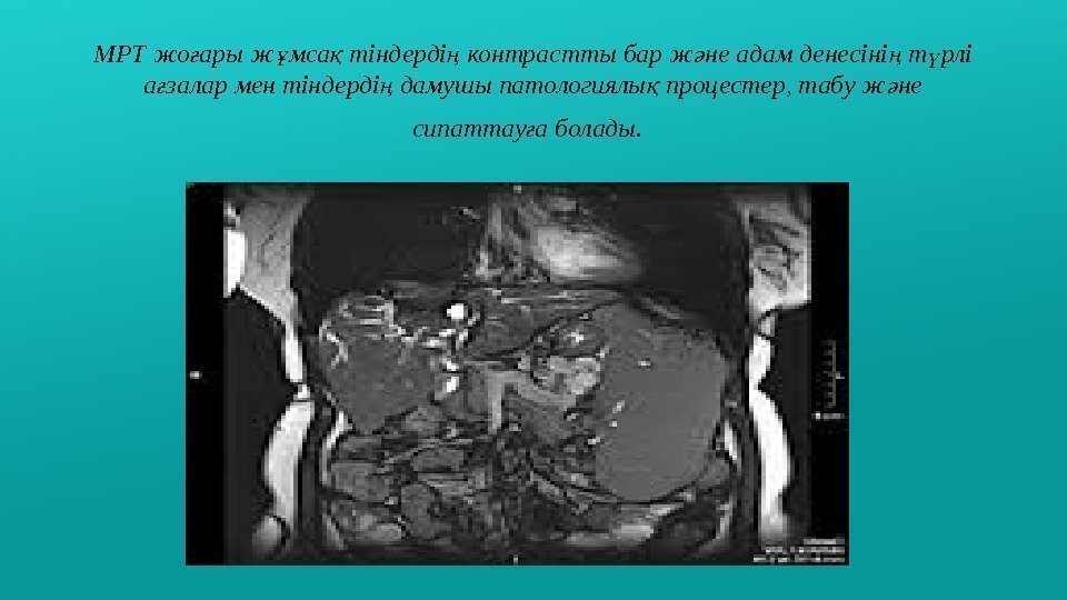 МРТ жо ары ж мса тіндерді контрастты бар ж не адам денесіні т рлі