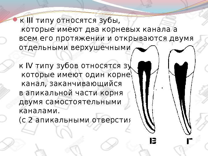  к III типу относятся зубы,  которые имеют два корневых канала а всем