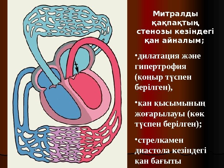 Митралды қақпақтың стенозы кезіндегі қан айналым ;  • дилатация ж не ә гипертрофия