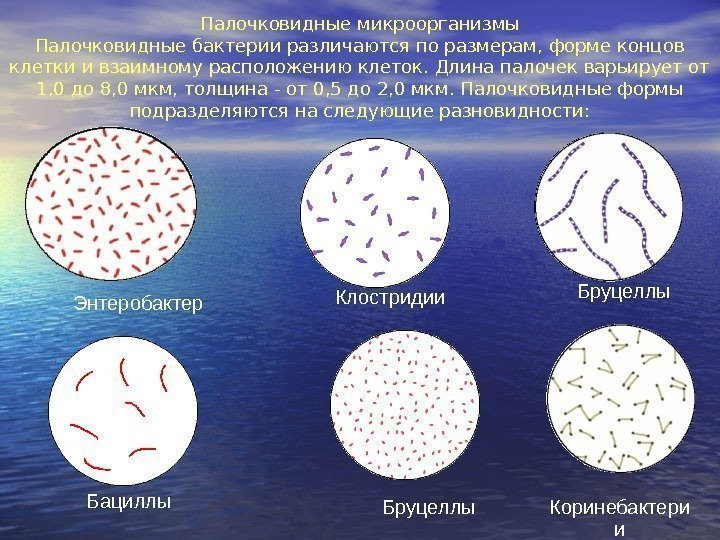   Энтеробактер Клостридии Бациллы Палочковидные микроорганизмы Палочковидные бактерии различаются по размерам, форме концов