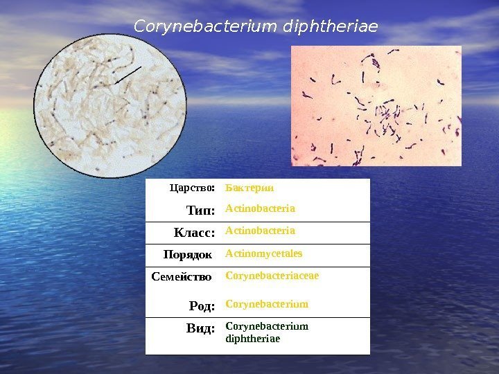   Corynebacterium diphtheriae  Царство: Бактерии Тип: Actinobacteria Класс: Actinobacteria Порядок : Actinomycetales