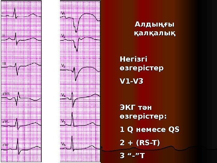 Алдыңғы қалқалық Негізгі өзгерістер  V 1 -V 3 ЭКГ тән өзгерістер: 1 Q