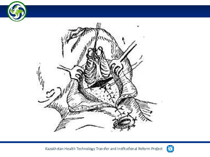 Kazakhstan Health Technology Transfer and Institutional Reform Project  