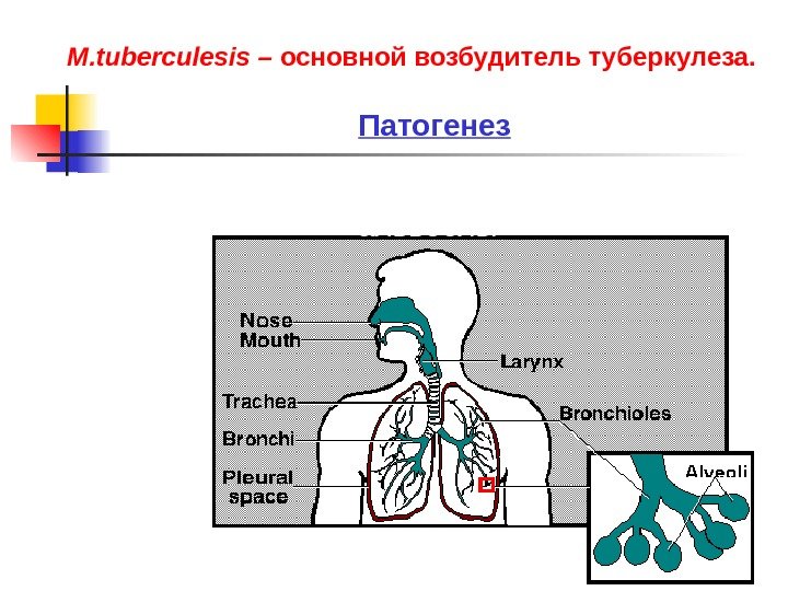 Заболевание начинается, когда капли достигают  альвеолы. M. tuberculesis – основной возбудитель туберкулеза. Патогенез