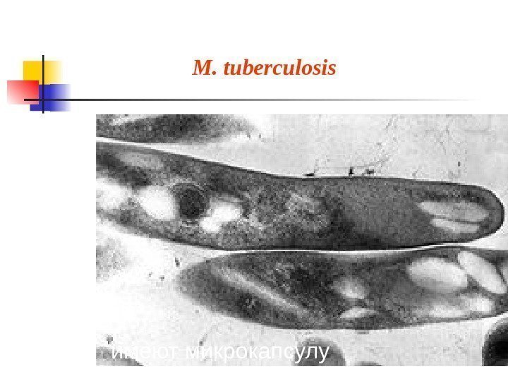 Трансмиссионная электронная микрофотография M. tuberculosis  имеют микрокапсулу 