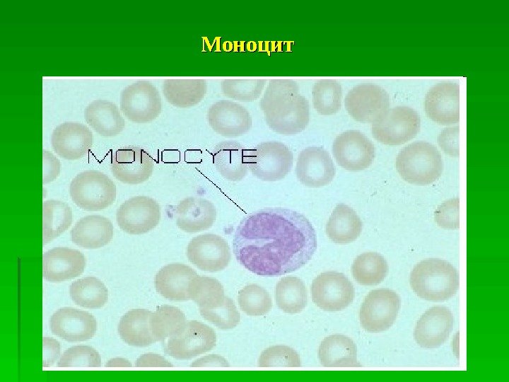   Моноцит  