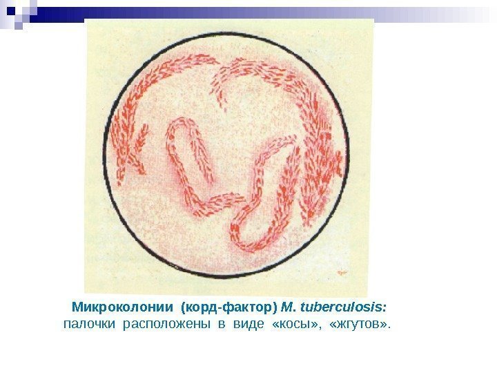Микроколонии (корд-фактор) M. tuberculosis : палочки расположены в виде «косы» , «жгутов» Микроколонии (корд-фактор) M. tuberculosis : палочки расположены в виде «косы» , «жгутов»