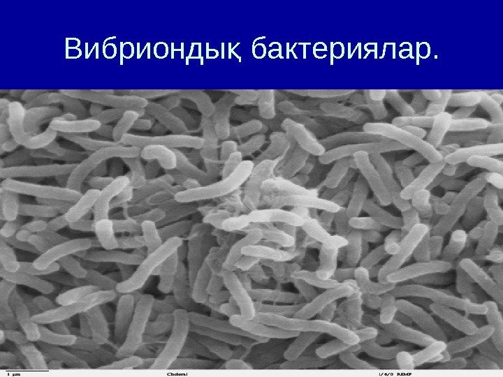   Вибрионды бактериялар. қ 