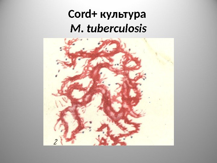 Cord+ культура M. tuberculosis 