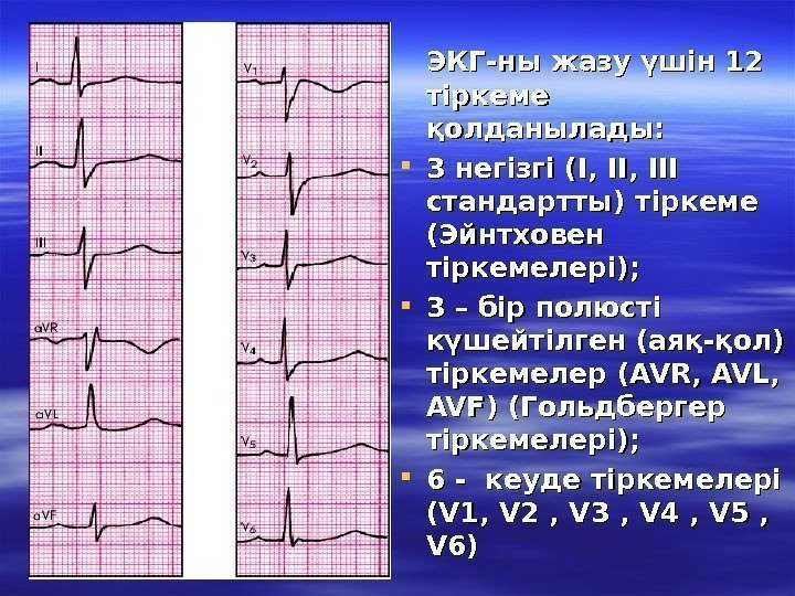   ЭКГ-ны жазу үшін 12 тіркеме қолданылады:  3 негізгі (І, ІІ, ІІІ