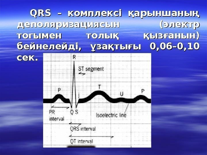   QRSQRS  – комплексі қарыншаның деполяризациясын (электр тогымен толық қызғанын) бейнелейді, 