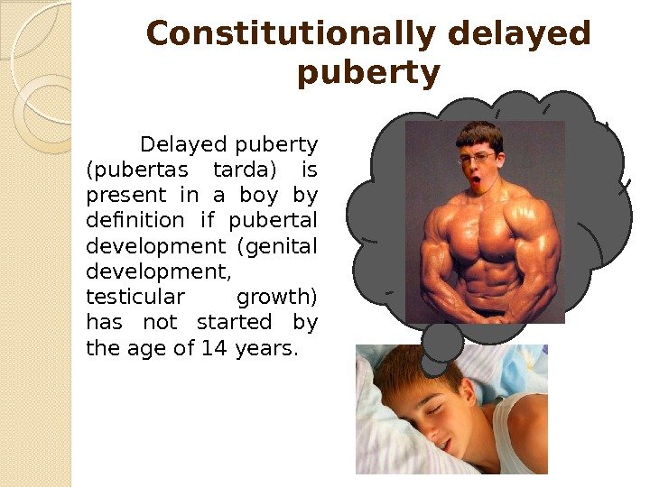 Constitutionally delayed puberty    Delayed puberty (pubertas tarda) is present in a