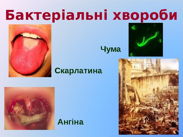 Бактеріальні хвороби Скарлатина Ангіна Чума 