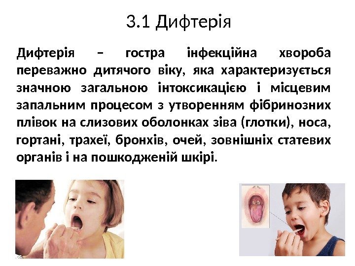 3. 1 Дифтерія – гостра інфекційна хвороба переважно дитячого віку,  яка характеризується значною