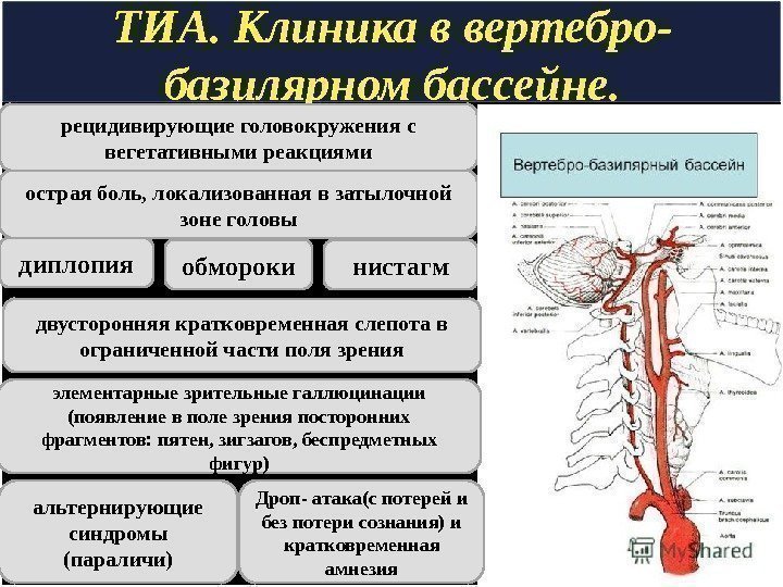 ТИА. Клиника в вертебро- базилярном бассейне. рецидивирующие головокружения с вегетативными реакциями острая боль, локализованная