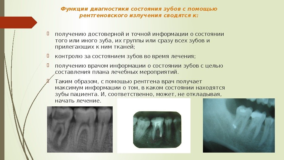 Функции диагностики состояния зубов с помощью рентгеновского излучения сводятся к:  получению достоверной и