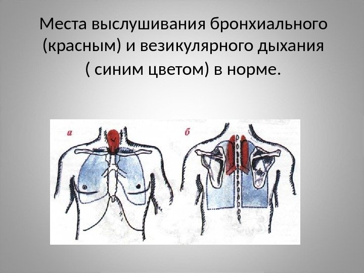 Места выслушивания бронхиального (красным) и везикулярного дыхания ( синим цветом) в норме.  