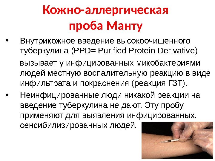   Кожно-аллергическая проба Манту • Внутрикожное введение высокоочищенного туберкулина ( PPD = Purified