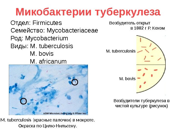   Микобактерии туберкулеза Отдел:  Firmicutes Семейство:  Mycobacteriaceae Род:  Mycobacterium Виды: