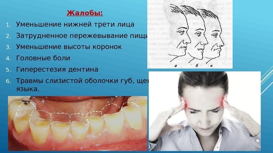 Жалобы: 1. Уменьшение нижней трети лица 2. Затрудненное пережевывание пищи 3. Уменьшение высоты коронок