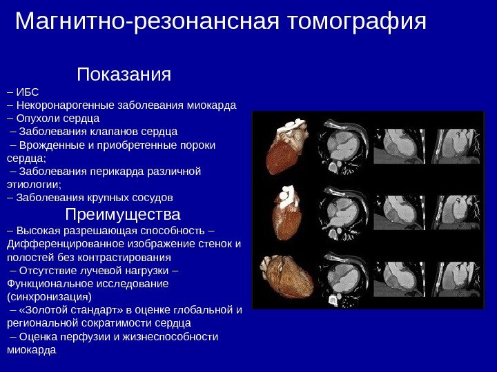 Магнитно-резонансная томография     Показания – ИБС – Некоронарогенные заболевания миокарда –